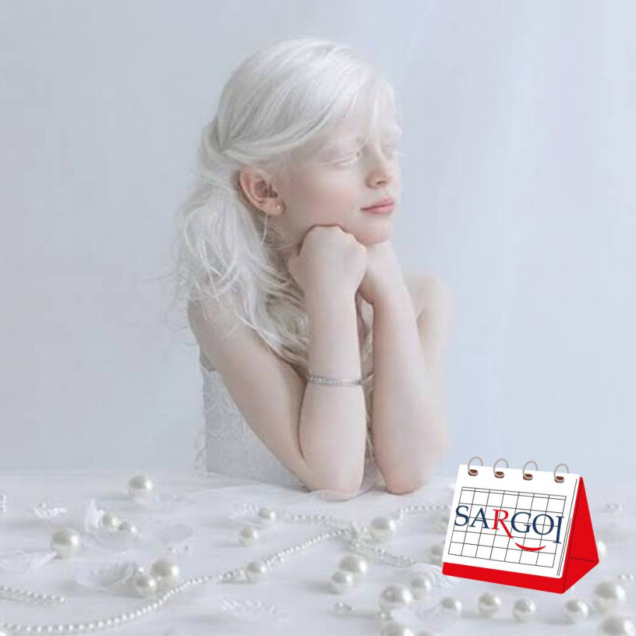 It’s June 13th: International Albinism Awareness Day